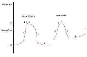 ekg2.jpg
