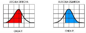 ekg4.jpg