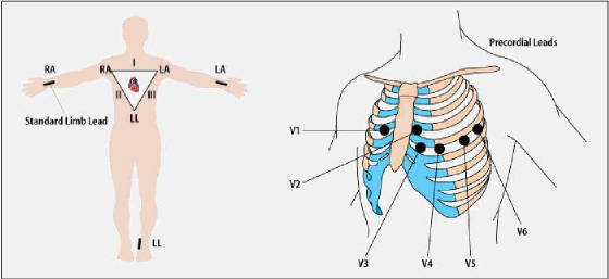 ekg7.jpg