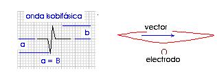 ekg10.jpg