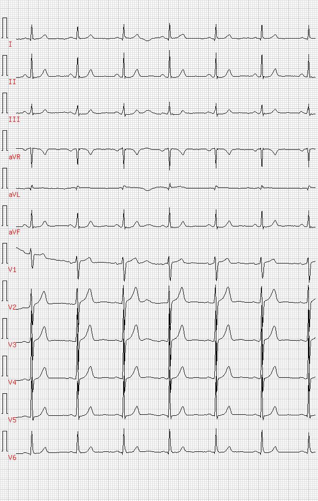 ekg11.jpg