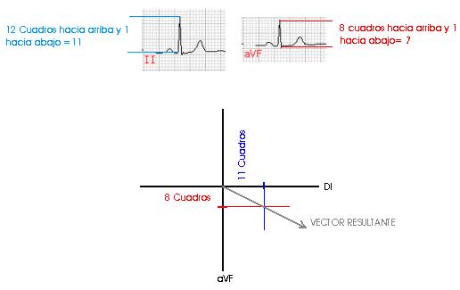 ekg12.jpg