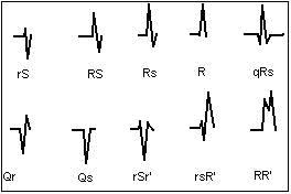 ekg3.jpg