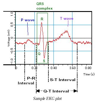 ekg6.jpg