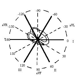 ekg8.jpg