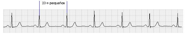 ekg9.jpg